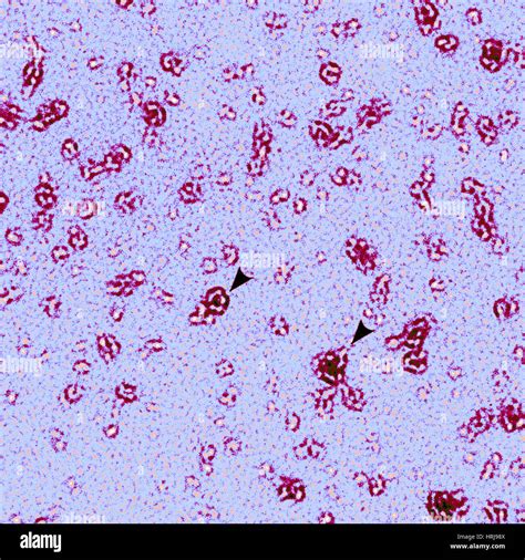 chlamydia on gram stain